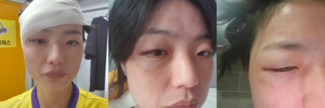 대표이미지