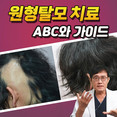 [홍성재 탈모 칼럼] 원형탈모 치료의 기본과 주의할 점